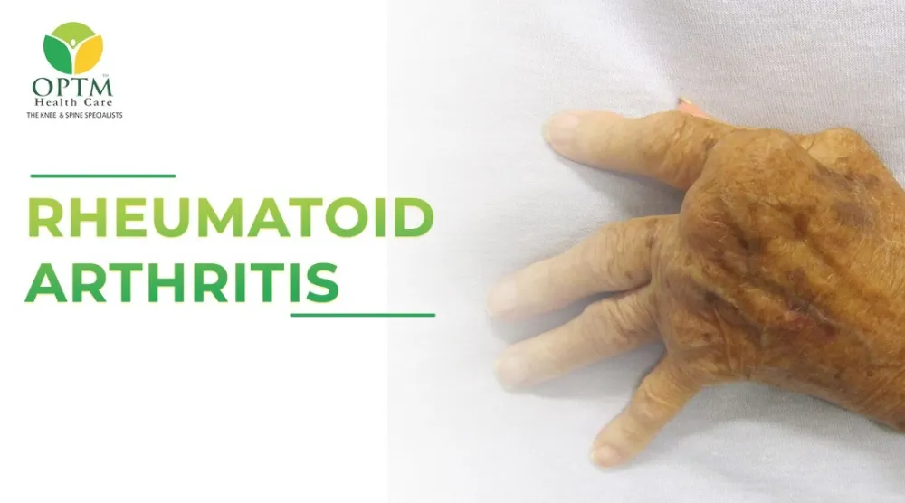 Read more about the article Top 7 tips to find relief from rheumatoid arthritis